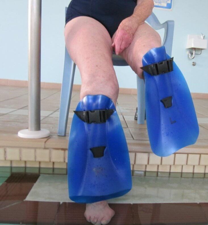 shinfin™ fins on below knee amputee with knee replacement: front view