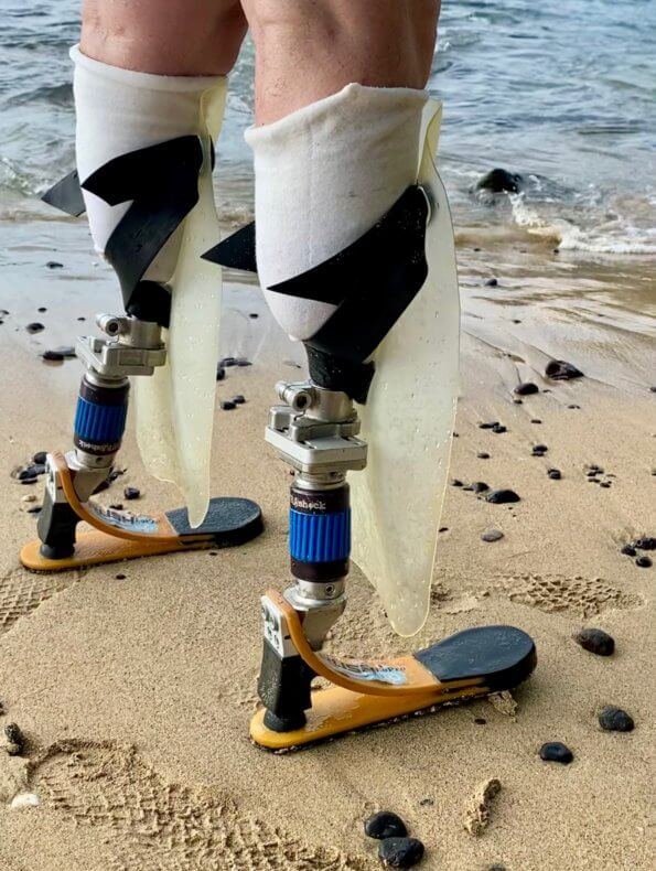shinfin™ fins on osseointegration prosthetic legs for bilateral below knee amputations: side view